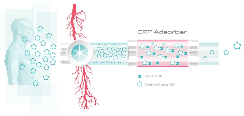 Technologie des PentraSorb® CRP Adsorbers